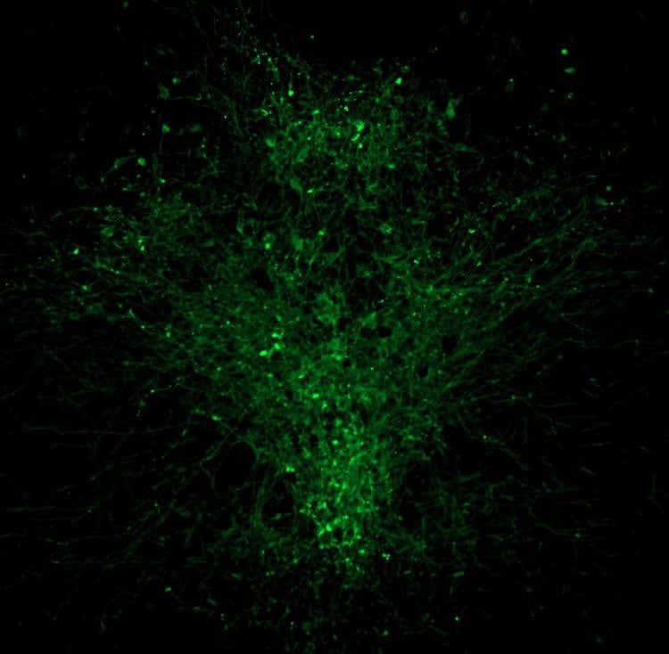 serotonin neurons